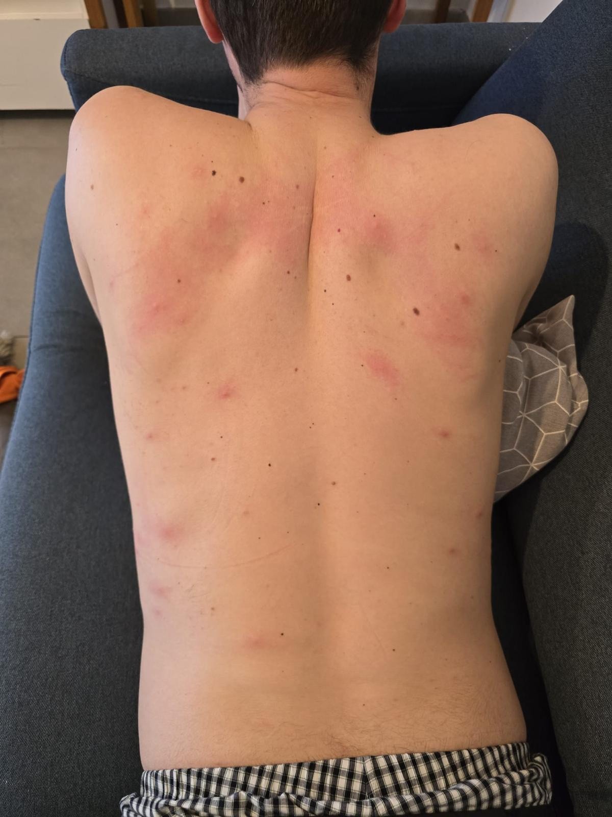 Assainissement vapeur sèche punaises de lit sur moquettes murales dans T1 infesté secteur Belle de Mai Marseille 3ᵉ.