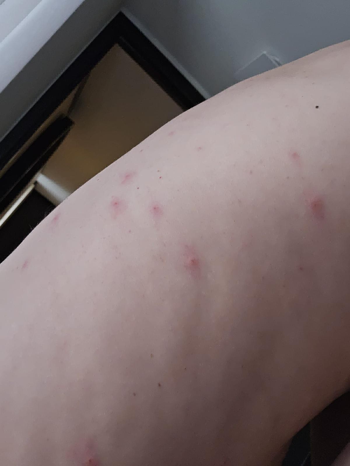 Désinsectisation vapeur sèche punaises de lit sur canapés et sommiers dans T3 infesté secteur Mazargues Marseille 9ᵉ.