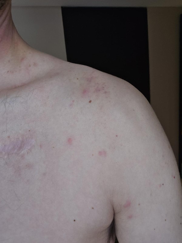Désinsectisation vapeur sèche punaises de lit sur literie et mobilier dans T1 infesté rue Sainte Marseille 1ᵉʳ.
